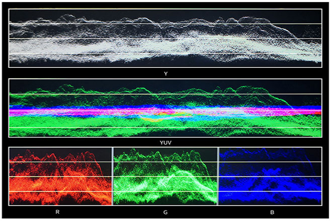 Video Analysis Assistant Pattern