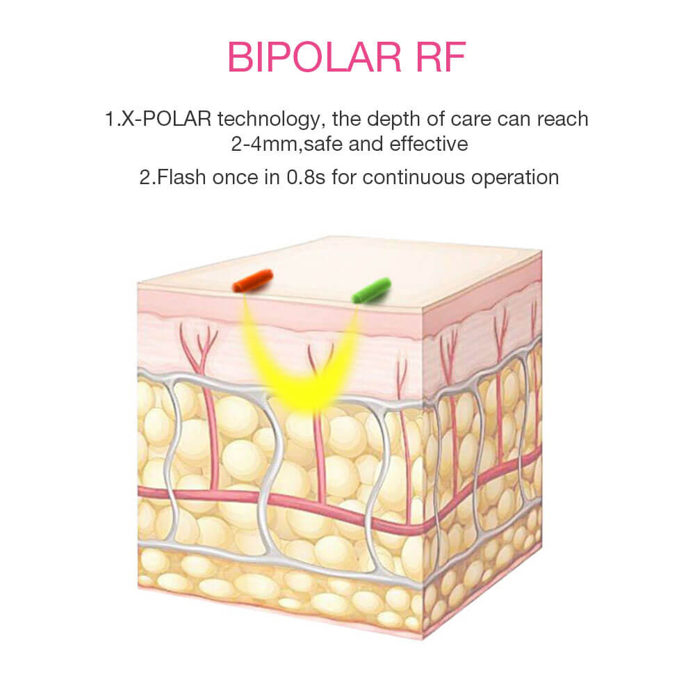 3 in 1 IPL RF Permanent Laser Hair Removal Machine At Home | Wolvpower