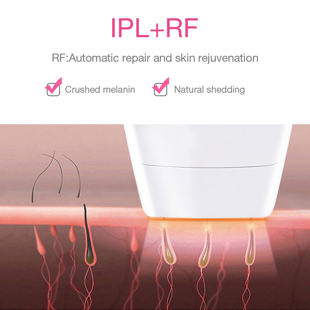 3 in 1 IPL RF Permanent Laser Hair Removal Machine At Home | Wolvpower