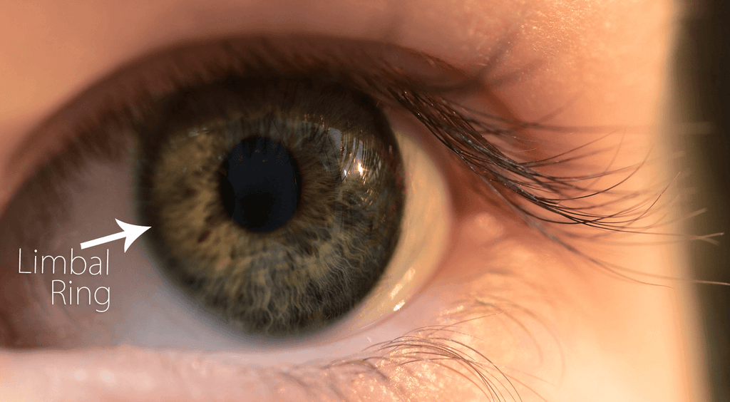 knal krullen Blauw Blog - Understanding Limbal Rings And Why They Are Attractive - TTDEYE